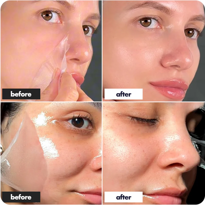 Romin™ — Collagen Mask